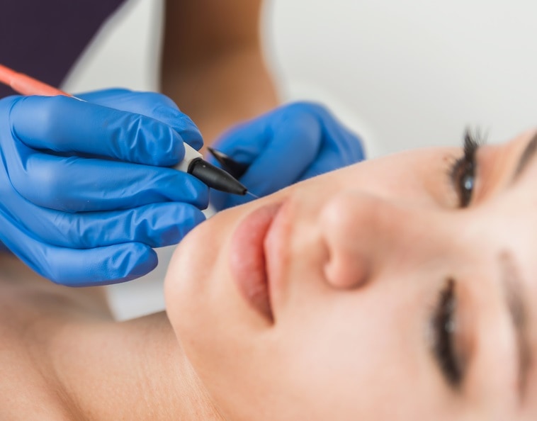 Electrolysis Beit Shemesh